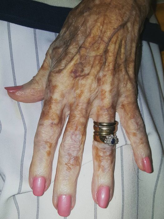 Nurse takes photo of old lady’s hand