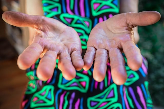 People who have this line on their hand are very special.