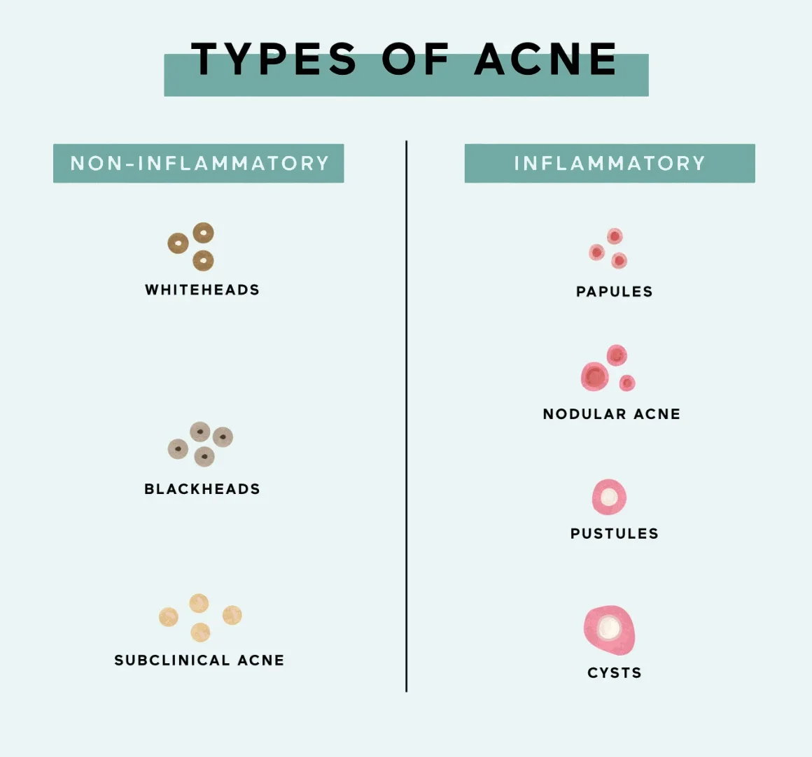 Causes of acne..