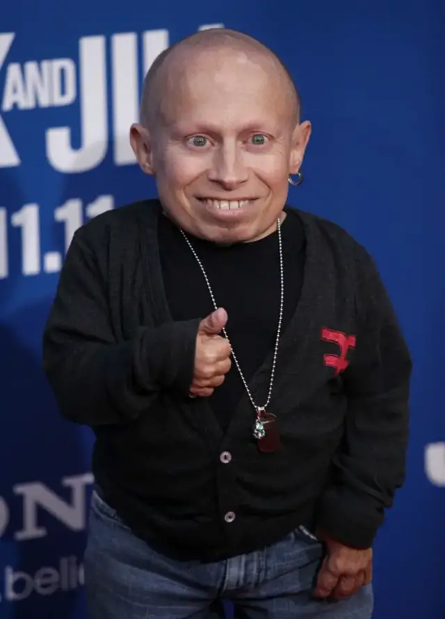 Verne Troyer tried changing stereotypes of ‘little people’ 