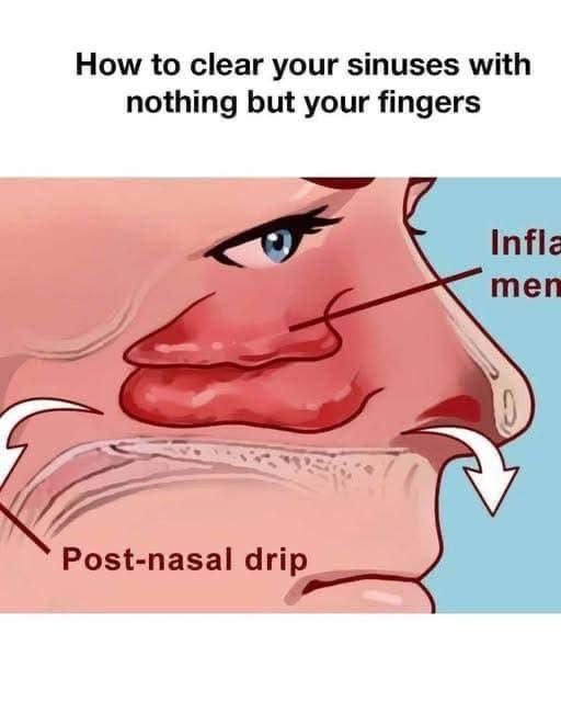 How to clear your sinuses in seconds with nothing but your fingers.