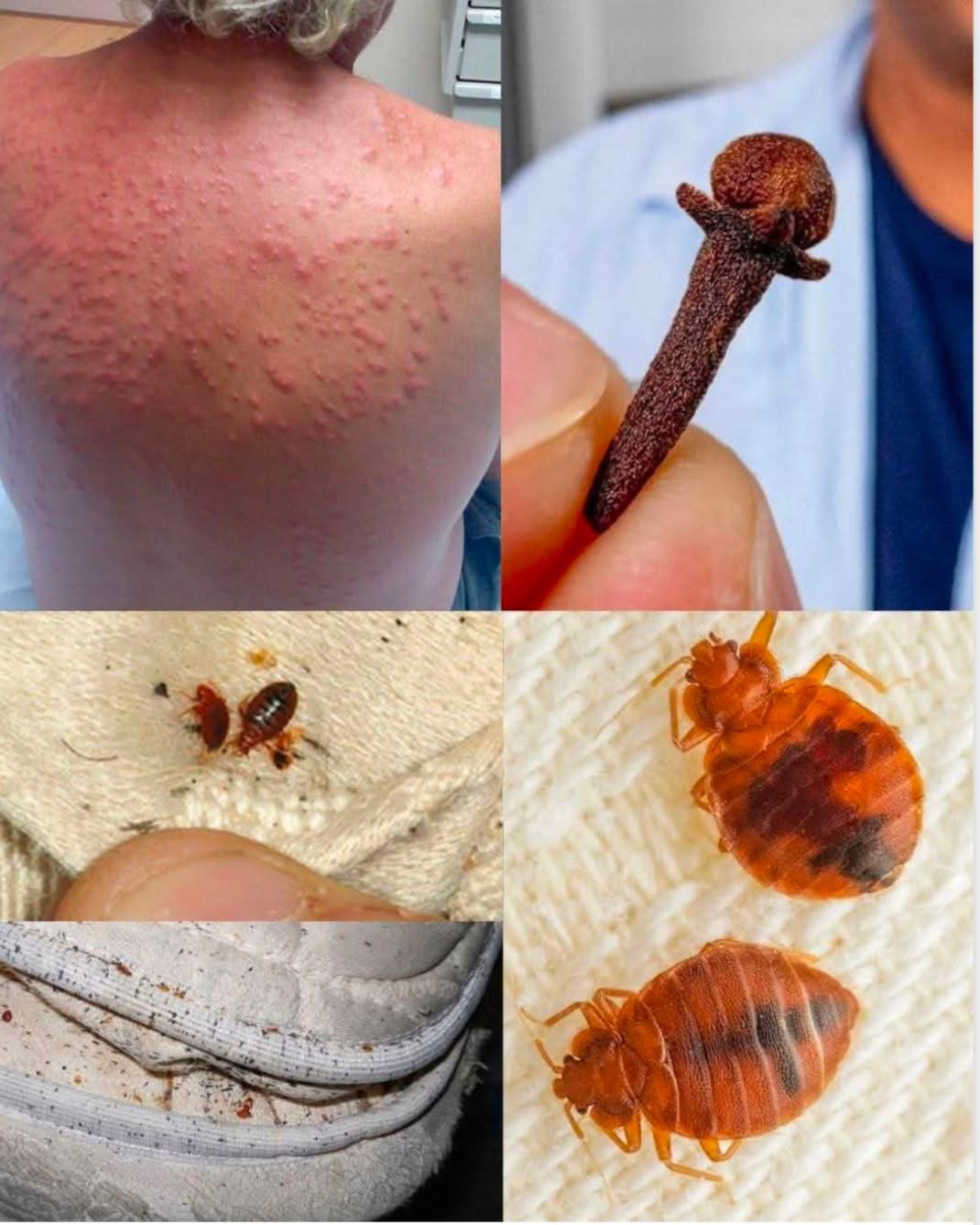 ⚠️ BE CAREFUL, if you get these bruises on your body, it means you have Ca…see more