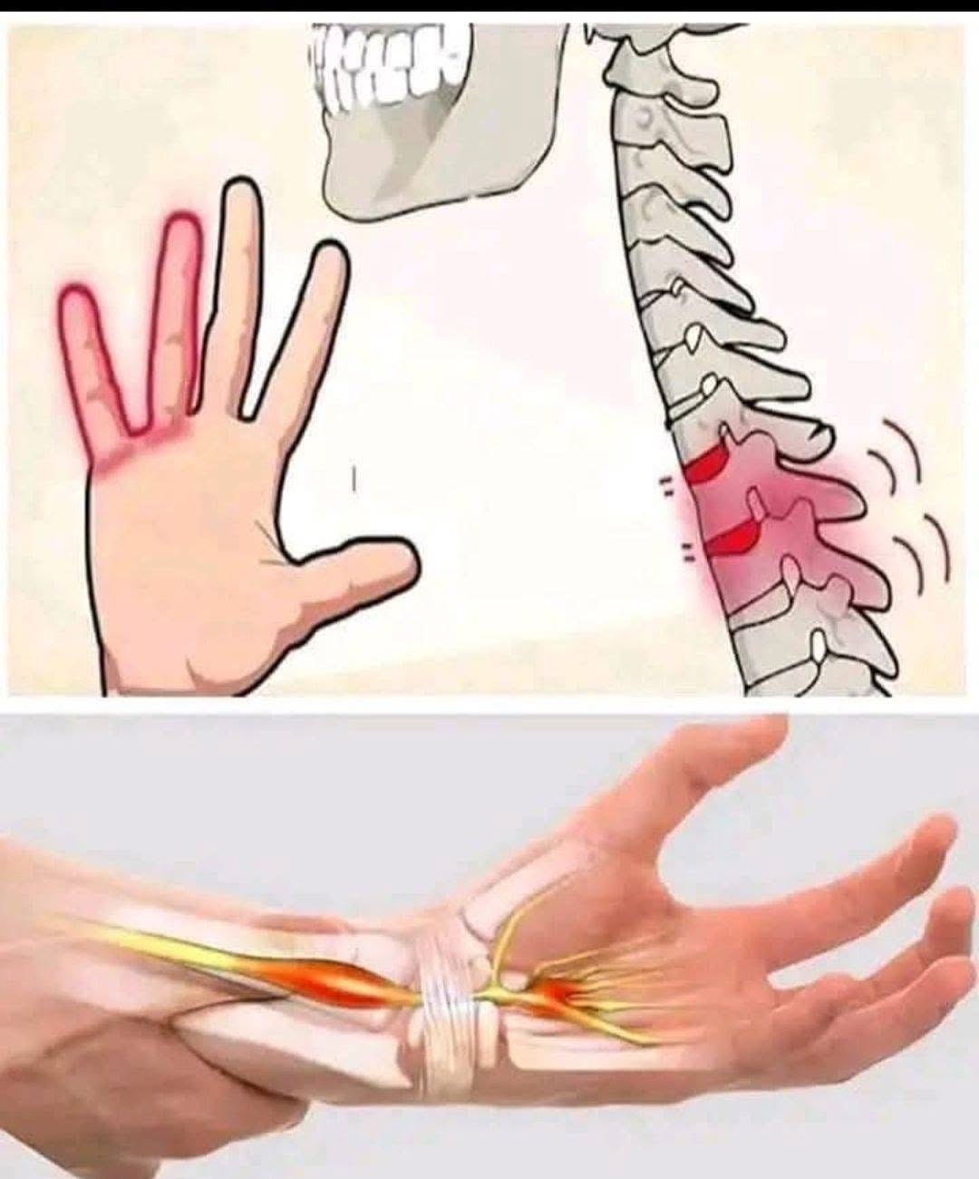 If your HANDS fall asleep it’s a clear sign that you have can