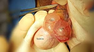 What’s Causing This Cyst?