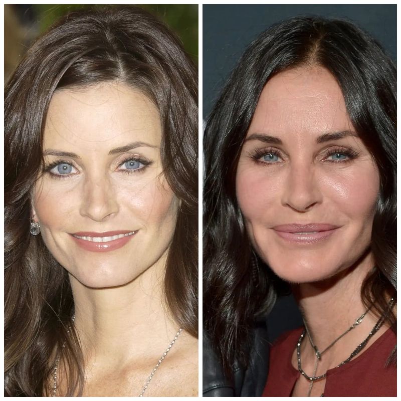 Well-known Stars Who Spent Millions Changing Their Looks